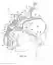 Fig. 04 - System and method for securing a gas delivery mask onto a subject's head