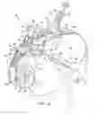 Fig. 04 - System and method for adjusting a gas delivery mask