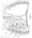 Fig. 06 - Methods and devices for inducing collapse in lung regions fed by collateral pathways