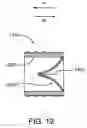 Fig. 20 - Methods and devices for inducing collapse in lung regions fed by collateral pathways