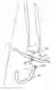 Fig. 01 - Nasal and oral cannula having two capabilities and method of producing same