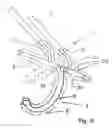Fig. 08 - Nasal and oral cannula having two capabilities and method of producing same