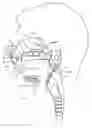 Fig. 01 - Nasopharyngeal airway device and method of use