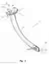 Fig. 05 - Nasopharyngeal airway device and method of use
