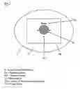 Fig. 04 - System and methods for the treatment of retinal diseases