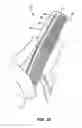Fig. 13 - Ouchless comb