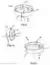 Fig. 04 - Hair accessory and method of styling hair