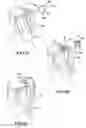 Fig. 18 - Hair accessory and method of styling hair