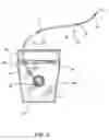 Fig. 03 - Interdental cleaning article with functional messages