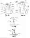 Fig. 19 - Modular system including shaft segments having configuration and breakdown attachments