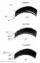 Fig. 06 - Pseudo-transmission method of forming and joining articles