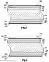 Fig. 05 - Heat exchanger and process for fabricating same