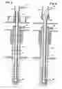 Fig. 05 - Method and apparatus for conducting earth borehole operations using coiled casing