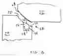 Fig. 11 - Filter valve for fluid loss device