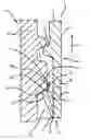Fig. 01 - Cap arrangements