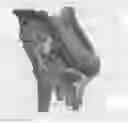 Fig. 01 - Sustained duration non-aerosol mechanical sprayer with a charging element load bearing surface