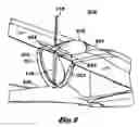 Fig. 05 - Propeller guard for aircraft