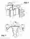 Fig. 03 - Bag support
