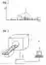 Fig. 03 - Method for combining PET with MR perfusion and diffusion