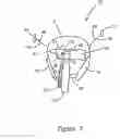 Fig. 04 - Apparatus and method for installing lines in conduits