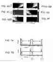 Fig. 05 - Method for spectrally selective B1 insensitive T2 preparation contrast enhancement for high field magnetic resonance imaging