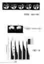 Fig. 07 - Method for spectrally selective B1 insensitive T2 preparation contrast enhancement for high field magnetic resonance imaging
