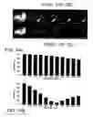 Fig. 08 - Method for spectrally selective B1 insensitive T2 preparation contrast enhancement for high field magnetic resonance imaging