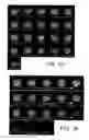 Fig. 09 - Method for spectrally selective B1 insensitive T2 preparation contrast enhancement for high field magnetic resonance imaging