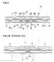 Fig. 06 - Pointing device and key sheet for pointing device
