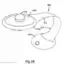 Fig. 13 - Inductively powered apparatus
