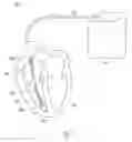 Fig. 06 - Flyback transformer wire attach method to printed circuit board