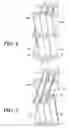 Fig. 07 - Detecting key actuation in a keyboard