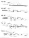 Fig. 05 - Plasma display panel aging method