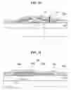 Fig. 14 - Array substrate for liquid crystal display device having defect repair structure