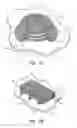 Fig. 04 - Distributed bragg reflector and method of fabrication