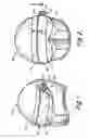 Fig. 02 - Dual tab lenses