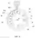 Fig. 04 - Spindle motor and recording disk drive having spindle motor