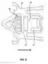 Fig. 09 - Method for reducing PSA tilt through standoff relocation