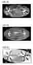 Fig. 09 - Device and method for computer tomography