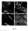 Fig. 12 - Contrast enhanced spectroscopic optical coherence tomography