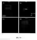 Fig. 13 - Contrast enhanced spectroscopic optical coherence tomography