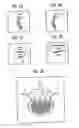 Fig. 03 - Method for acquisition, analysis and representation of a medical image data set