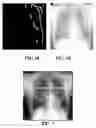 Fig. 08 - Method, apparatus and storage medium for detecting cardio, thoracic and diaphragm borders