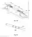 Fig. 05 - Fiber anchoring method for optical sensors