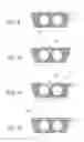 Fig. 06 - SUBTERRANEAN STORAGE VESSELS AND INSTALLATION THEREOF