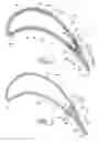 Fig. 03 - Trailing edge attachment for composite airfoil
