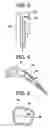 Fig. 03 - Turbine bucket tip cap