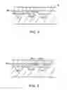 Fig. 05 - Microfabricated structures for facilitating fluid introduction into microfluidic devices