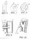 Fig. 03 - Combination drug therapy for reducing scar tissue formation