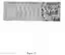 Fig. 14 - Combination drug therapy for reducing scar tissue formation